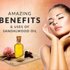 Sandalwood Oil: The Miraculous Healer and Glow Giver of Nature